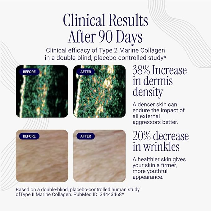 Liposomal Collagen Peptides - High-Absorption Liquid Collagen Supplement - Supports Skin Elasticity, Joint Health, and Overall Vitality for Healthy Aging, 5 fl oz